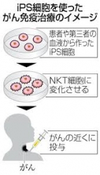 nkt細胞